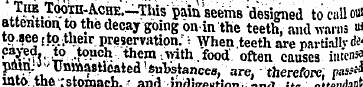 JS. TSPr a-AcHE.-This pain seems'designe...